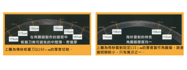 角膜瓣厚度比較圖