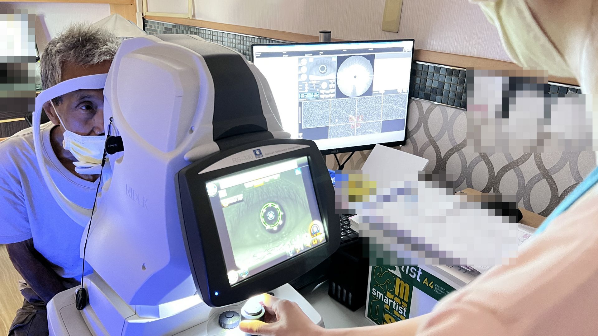 3D光學電腦斷層